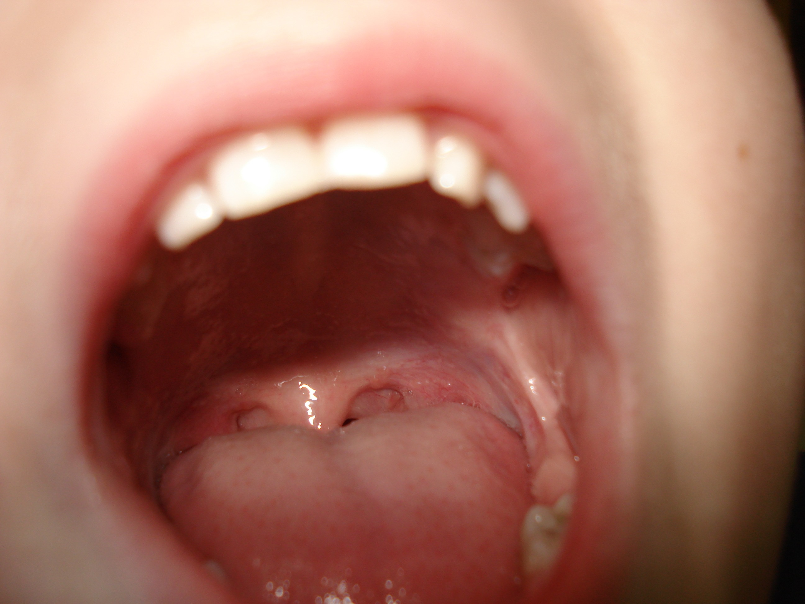 Close up on child's open mouth