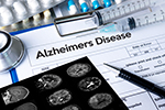 594-alzheimers