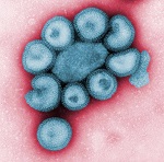 634-spanishflu