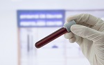 656-bloodtest