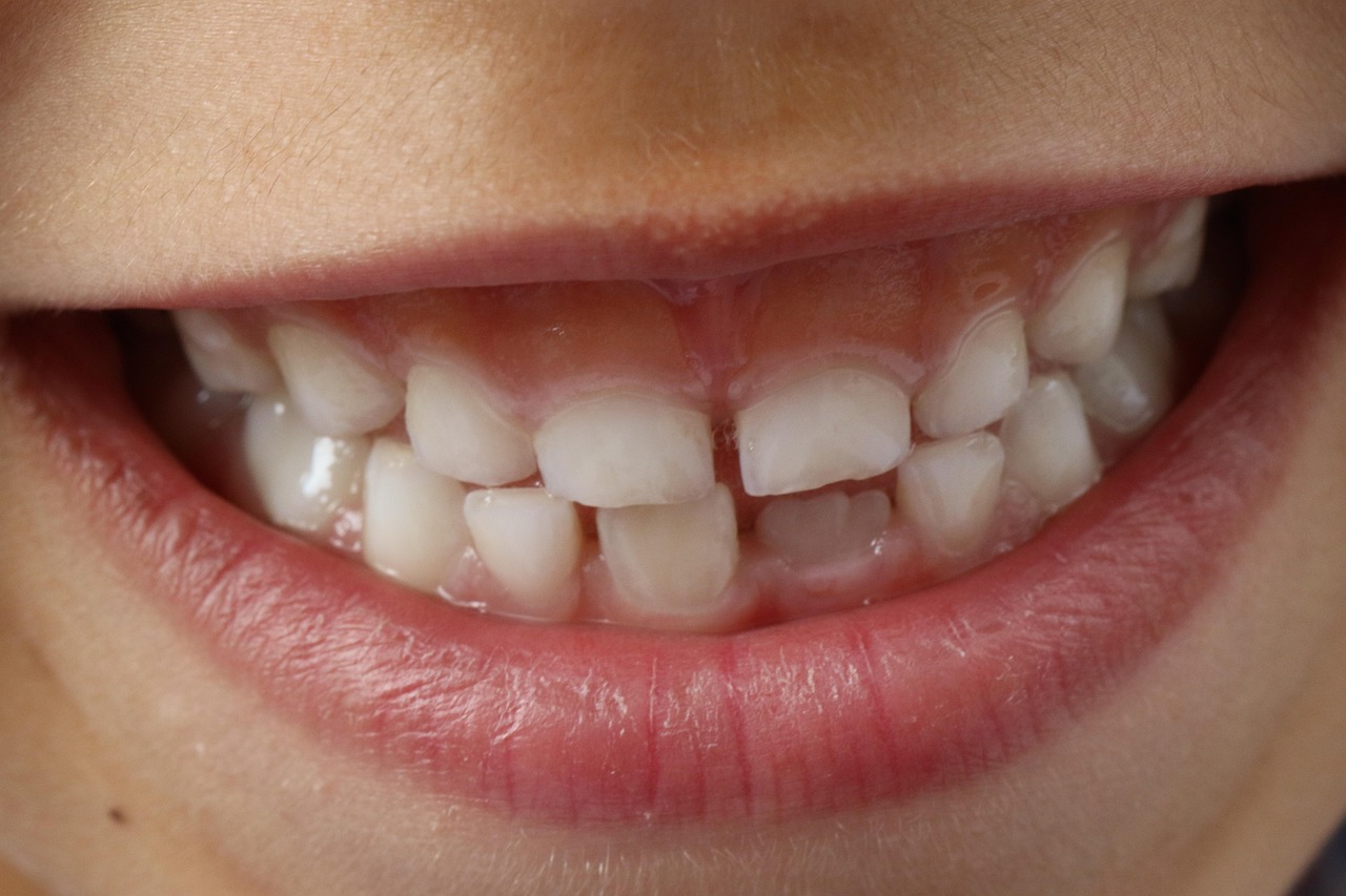 976 Growing new teeth person smiling showing their teeth